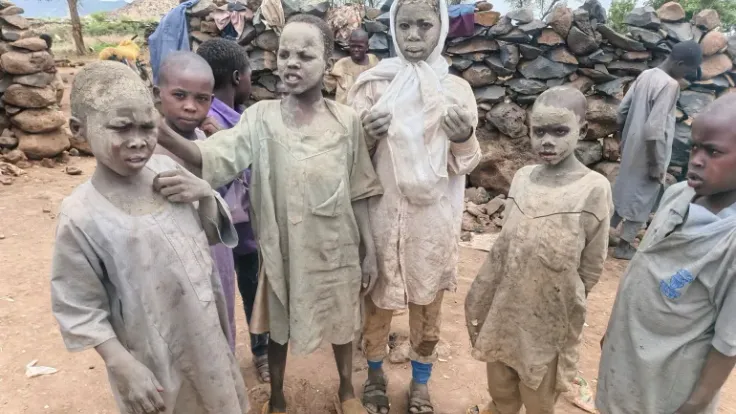 تفاقم تفشي الحصبة في جبل مرة: أزمة صحية تهدد آخر معاقل دارفور