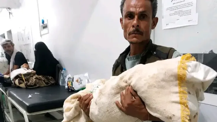 وفاة طفلة يمنية بسبب غياب العناية المركزة في مستشفى تعز