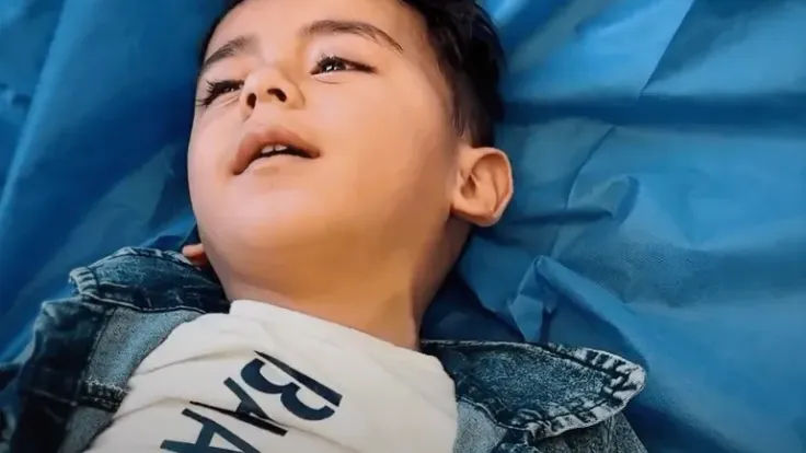 عملية جراحية معقدة تنقذ طفلا من إعاقة دائمة في غزة رغم انهيار القطاع الصحي