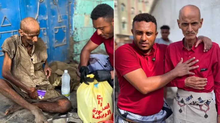 فيديو يسلط الضوء على طبيب عظام مصري مشرد في شوارع الحديدة يثير تعاطفاً واسعاً