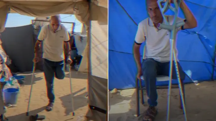 أسير فلسطيني يروي تفاصيل بتر ساقه في سجون الاحتلال الإسرائيلي