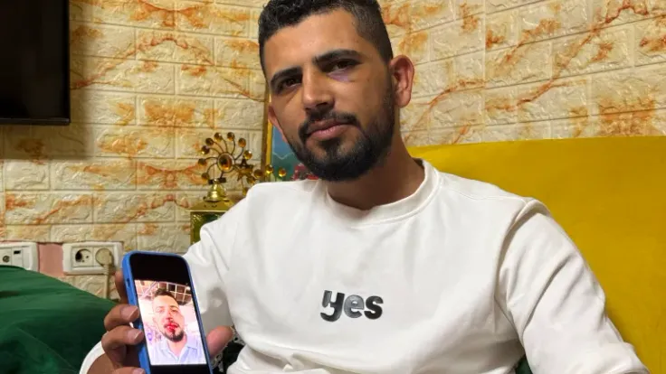 سائق مقدسي يُضرب حتى الإغماء في تل أبيب: اعتداء عنصري