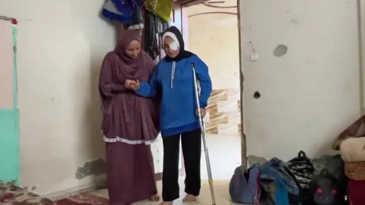 معاناة مصابي غزة مع التشوهات والحروق في ظل نقص الإمكانات الطبية