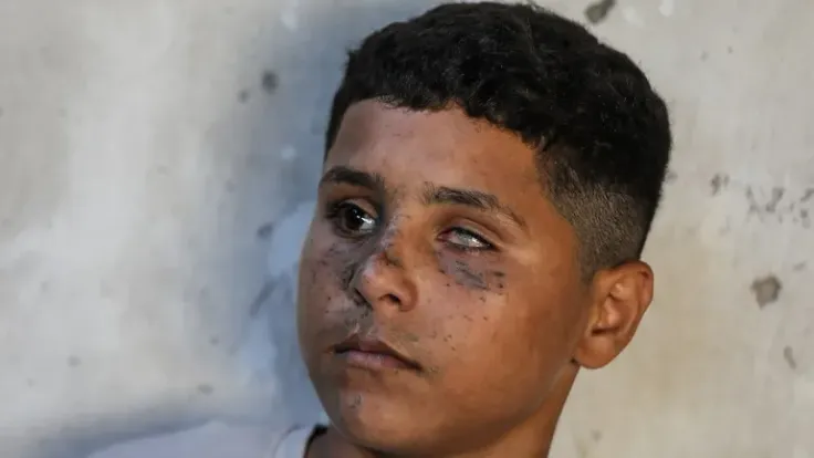 طفل غزة عادل العشي: الحرب الإسرائيلية تحصد طفولة الأبرياء